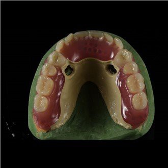 جھانکنا فریم ورک ڈینچر