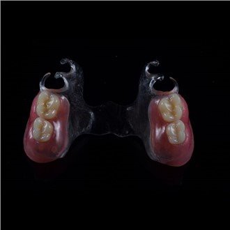 ہٹنے والا ایکریلک جزوی دانت