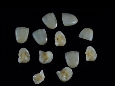 تاج کے لئے دانتوں کا بہترین گلو منتخب کرنے کا طریقہ: ایک تازہ ترین گائیڈ